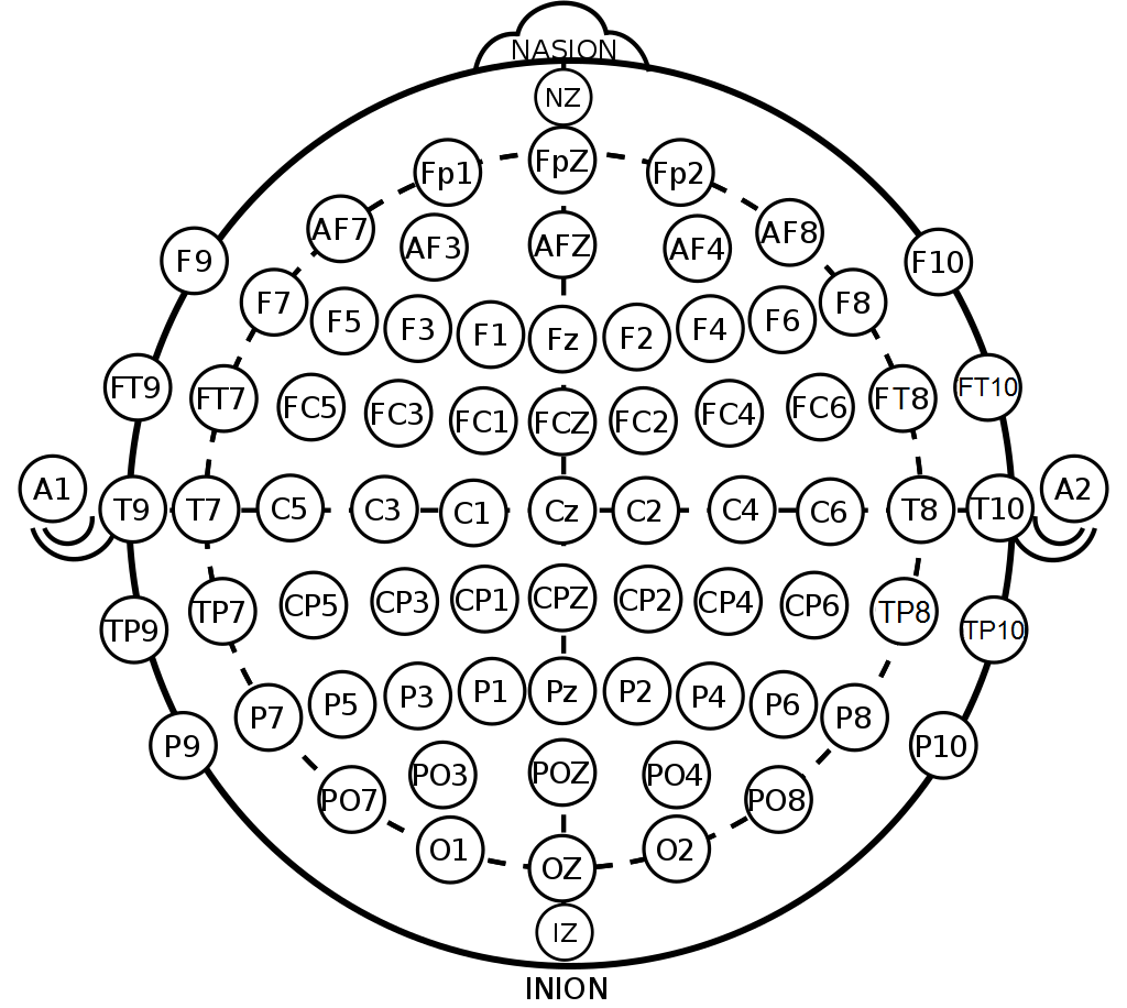 International 10-20 EEG electrode placement diagram (modified combinatorial nomenclature)